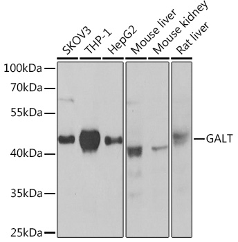 GALT antibody