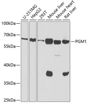 PGM1 antibody