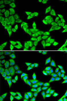 CIAPIN1 antibody