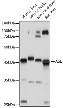 ASL antibody