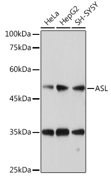 ASL antibody