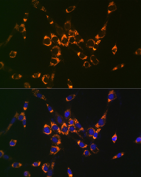 ASL antibody