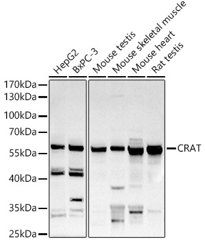 CRAT antibody