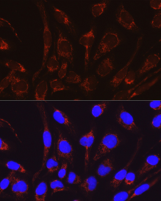 CRAT antibody