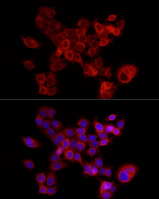 FABP5 antibody