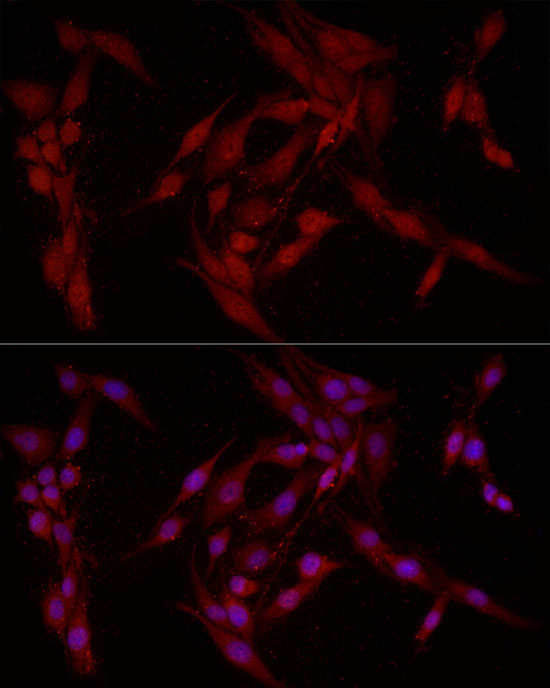 FABP5 antibody