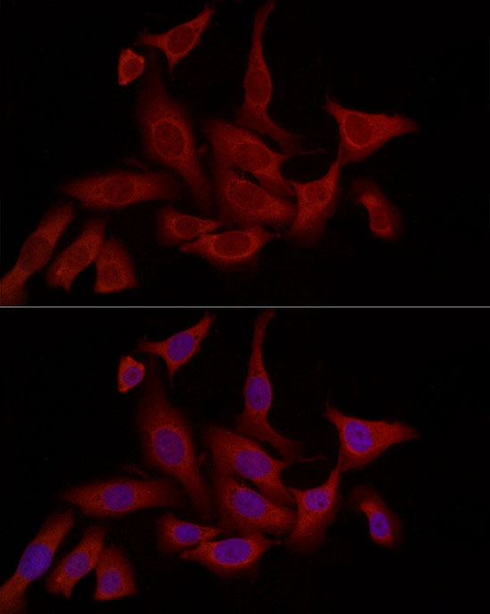 FABP5 antibody