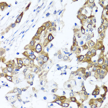 PPOX antibody