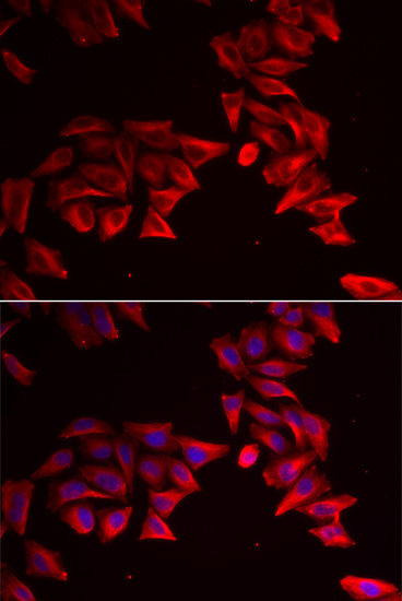 SFRP4 antibody