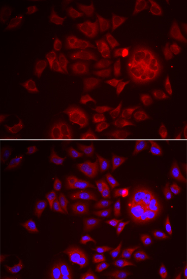 SPINT1 antibody