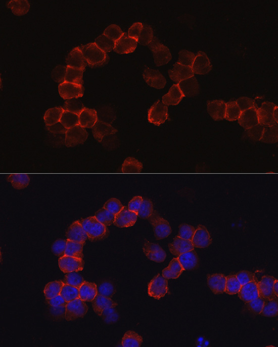 SPN antibody