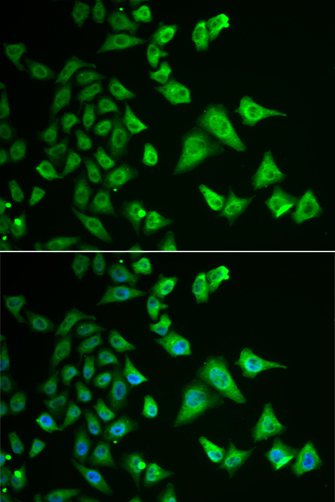 DHRS2 antibody