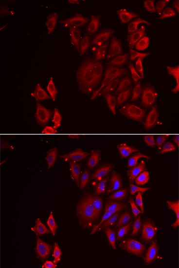 PAICS antibody