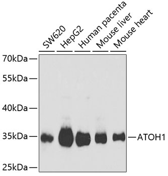 ATOH1 antibody