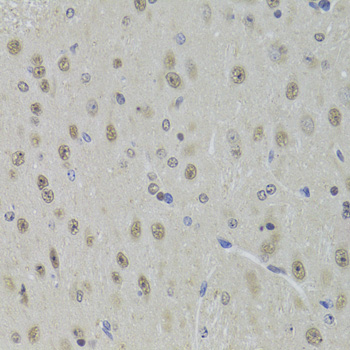 DDX1 antibody