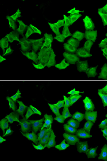 HAGH antibody