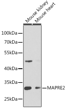 MAPRE2 antibody