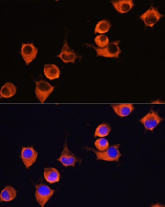 MFI2 antibody