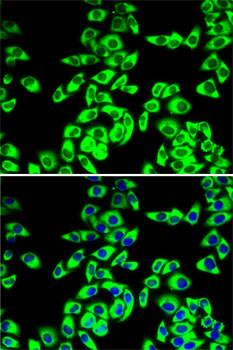 RPL14 antibody