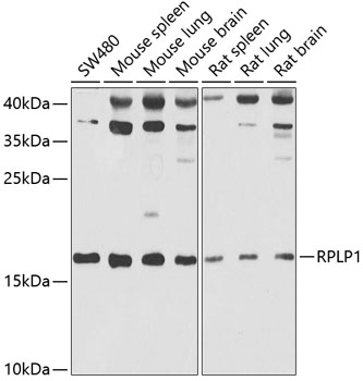 RPLP1 antibody