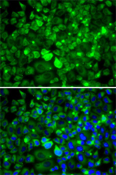 RPLP1 antibody