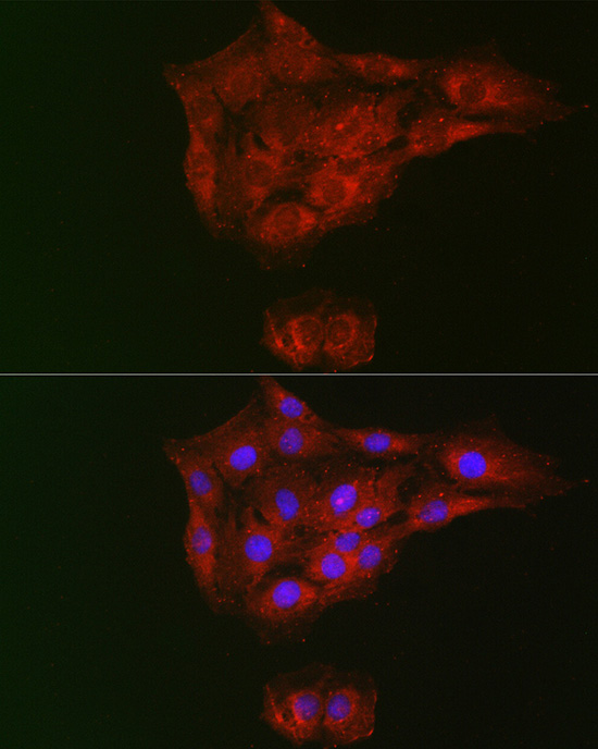 RTKN antibody