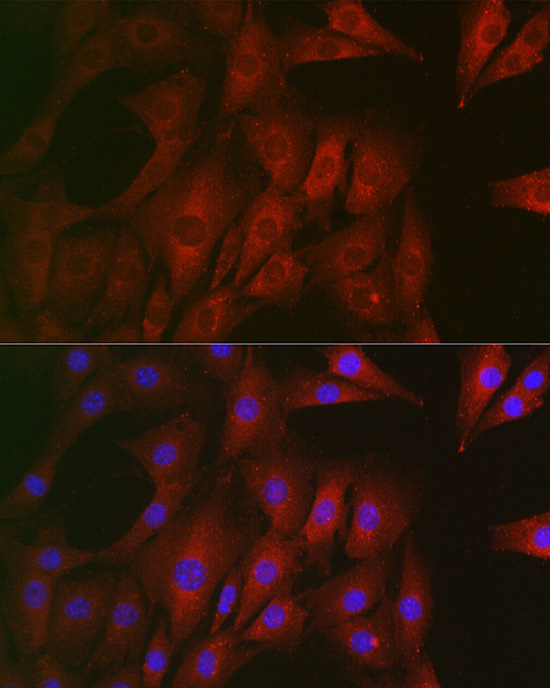 RTKN antibody