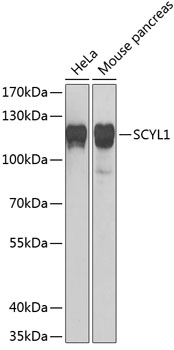 SCYL1 antibody