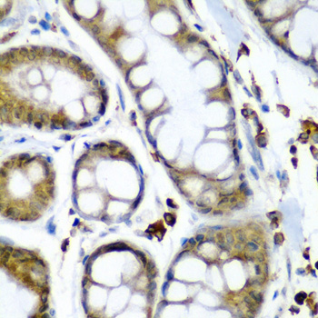 SECISBP2 antibody