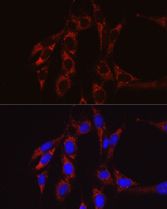 SECISBP2 antibody