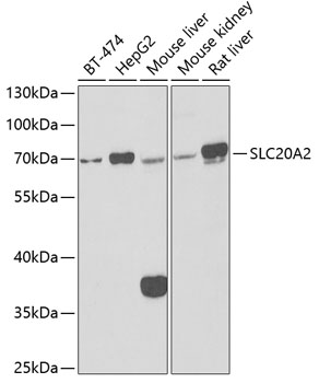 SLC20A2 antibody