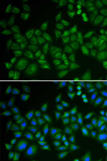 SMPD1 antibody