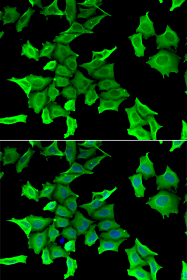 SPINT2 antibody