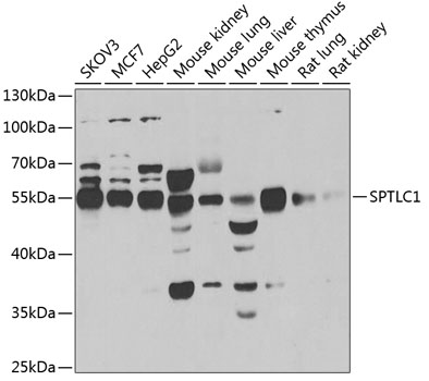 SPTLC1 antibody