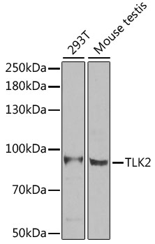 TLK2 antibody