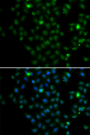 LMO4 antibody