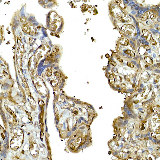 IFIH1 Rabbit Polyclonal Antibody