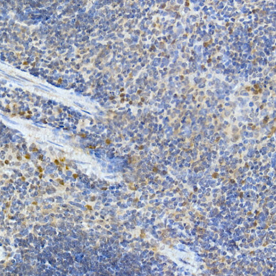 IFIH1 Rabbit Polyclonal Antibody