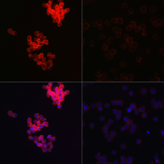 IFIH1 Rabbit Polyclonal Antibody
