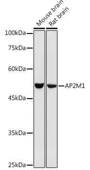 AP2M1 Rabbit Polyclonal Antibody