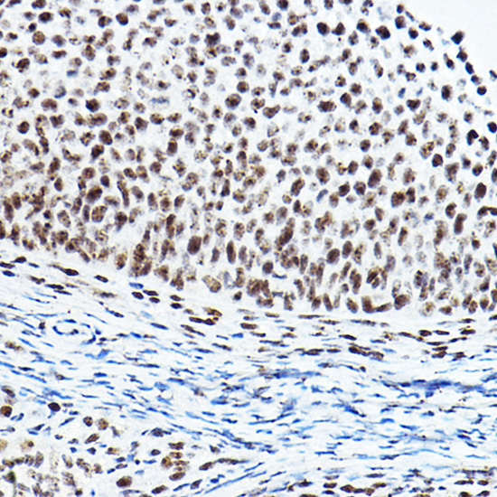 PAXIP1 Rabbit Polyclonal Antibody