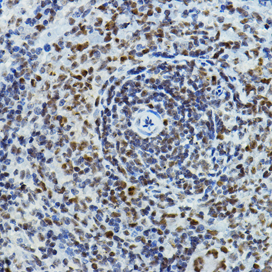 PAXIP1 Rabbit Polyclonal Antibody