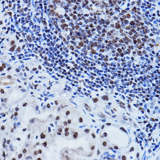 PAXIP1 Rabbit Polyclonal Antibody