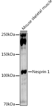 SYNE1 Rabbit Polyclonal Antibody