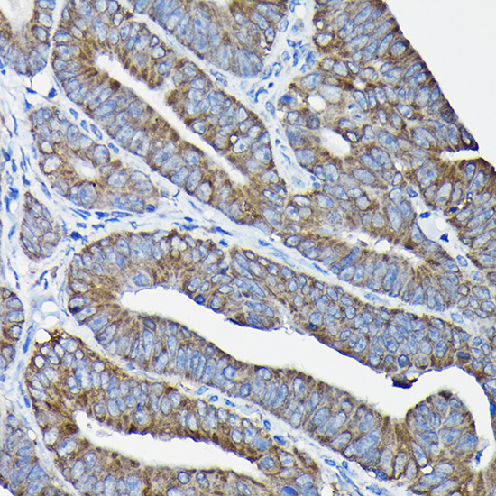SYNE1 Rabbit Polyclonal Antibody