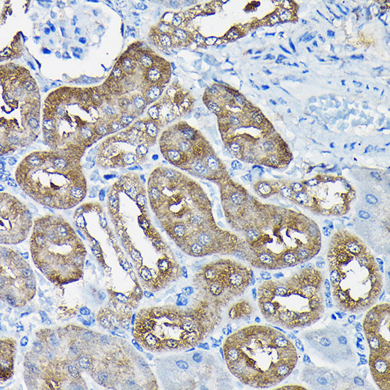 SYNE1 Rabbit Polyclonal Antibody