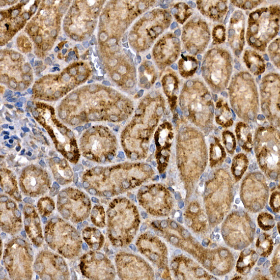 DVL3 Rabbit Polyclonal Antibody