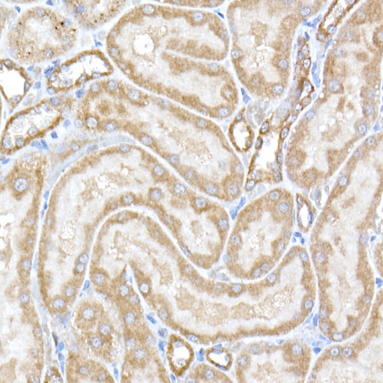 OPA1 Rabbit Polyclonal Antibody