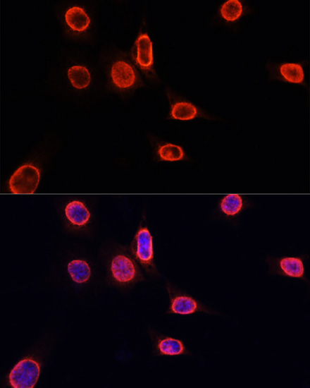 Histone H3K9me1 Polyclonal Antibody