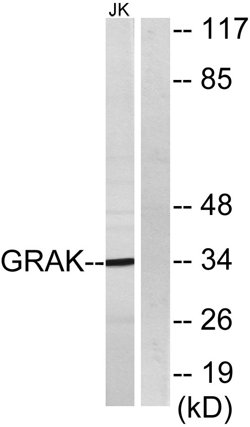 Granzyme K Polyclonal Antibody